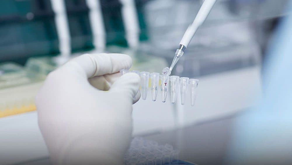 การเตรียมตัวอย่างตรวจพันธุกรรมตัวอ่อนในหลอด PCR